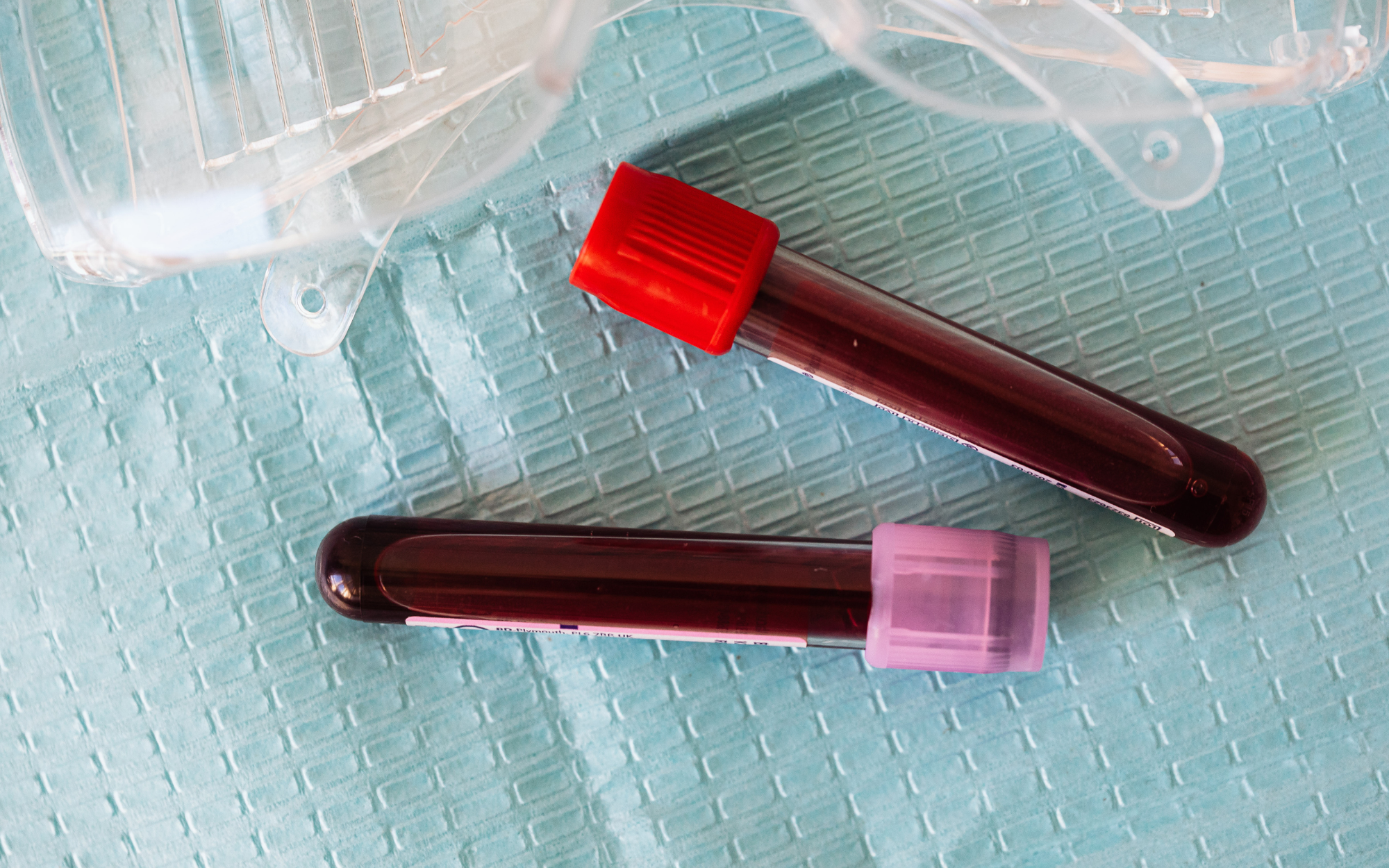 Iron Panel Lab Values Refrence Ranges Your Guide to Iron Tests: How often should I be checking my iron level ...