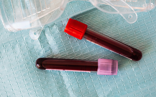 Two Blood Sample Files